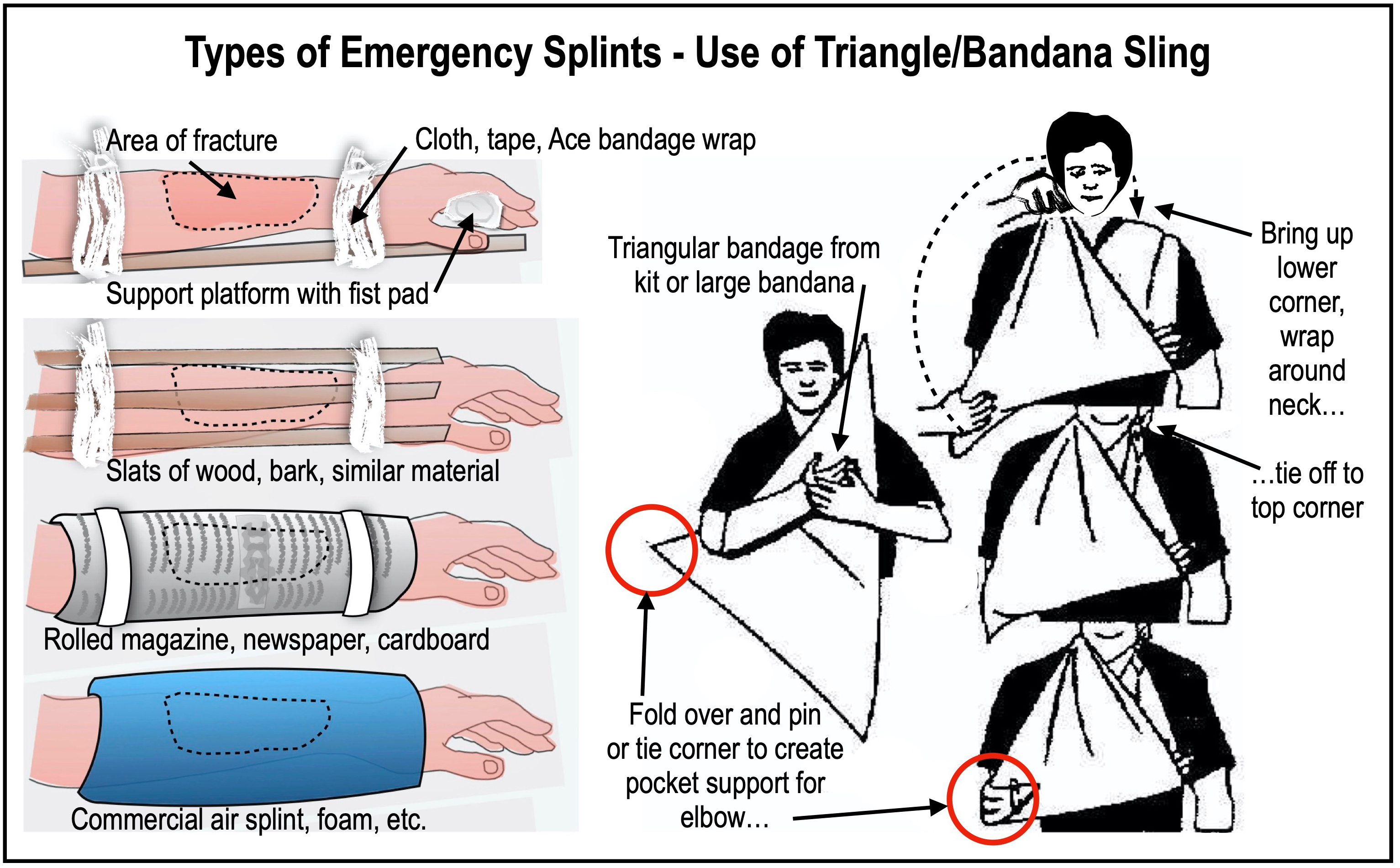 Field First Aid Quick Fixes – TOMOUTDOORS.COM